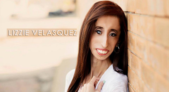 Lizzie-Velasquez