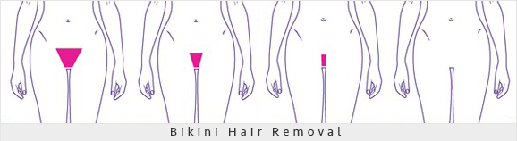 Bikini-Hair-Removal-